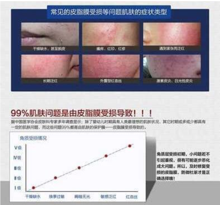 為什么你的臉容易過敏？